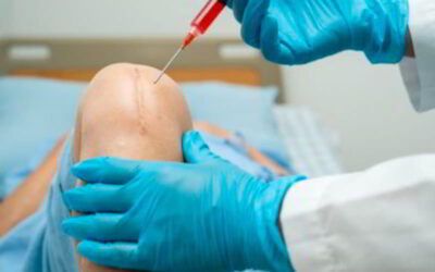 Cómo el plasma rico en plaquetas está ayudando a mejorar la rehabilitación física en Riobamba